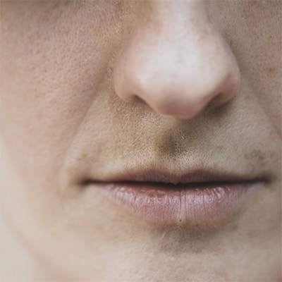 thin lips skin condition